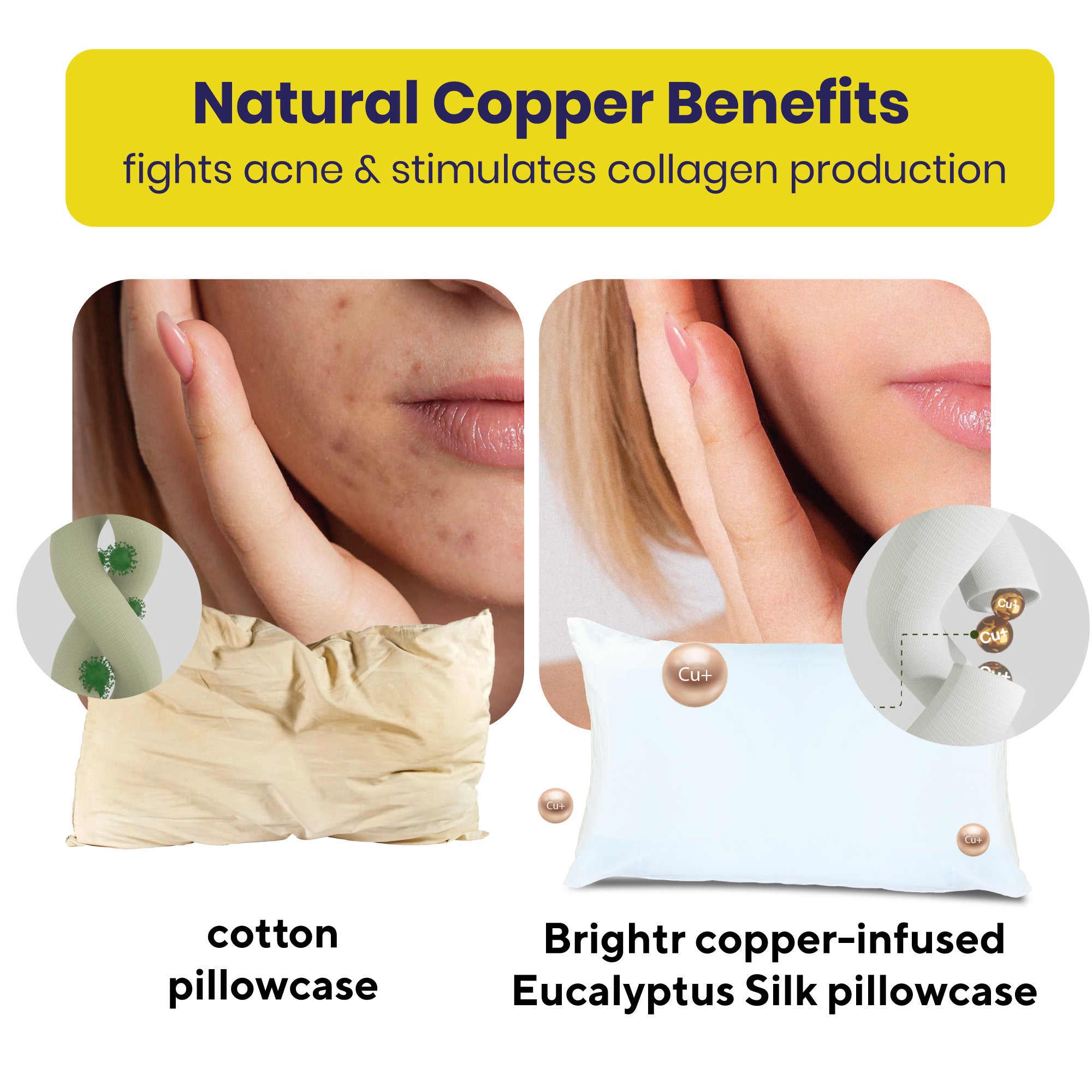 Brightr® Copper Eucalyptus Silk Pillowcase | Anti-Aging, Anti-Acne, Cooling